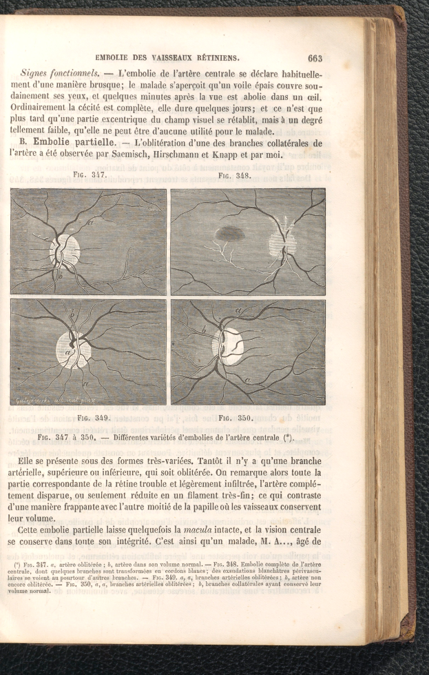 Ein aufgeschlagenes Buch mit einer Zeichnung eines Gehirns auf dem Cover, das auf einer Oberfläche liegt und Bilder und Text über das Gehirn enthält.